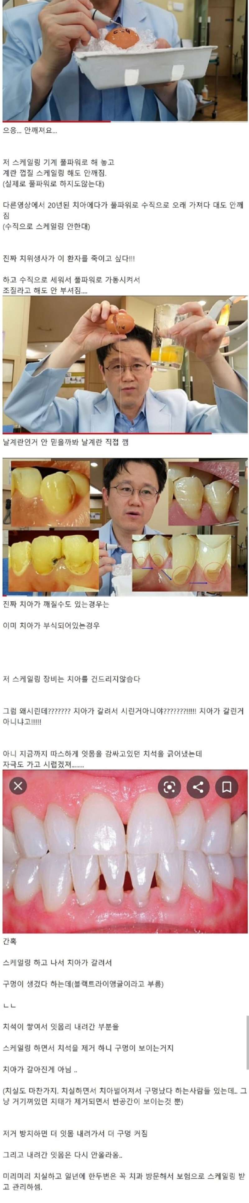 [정보] 사람들이 스케일링에 대해 가지고 있는 오해.jpg